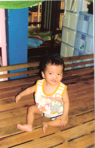 Chi Huong was born with a cleft lip and palate. We hope to be able to help him get the surgical procedure that will restore his bright smile one day.